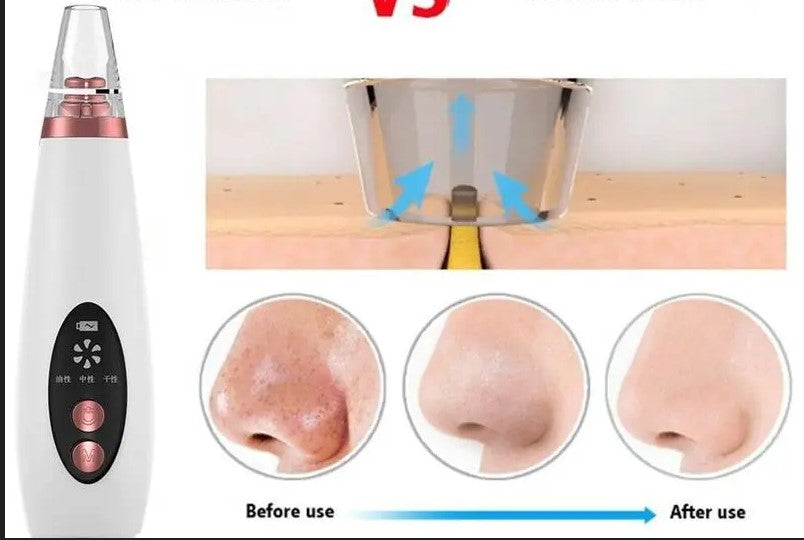 How to Use a Pore Vacuum Safely for Clearer, Healthier-Looking Skin — Even as It Matures