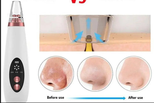 How to Use a Pore Vacuum Safely for Clearer, Healthier-Looking Skin — Even as It Matures