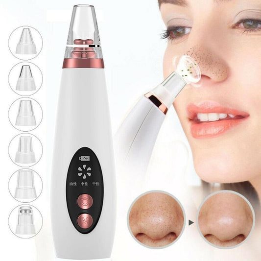 Blackhead Remover Pore Vacuum – Face & Nose Acne Suction Cleanser Tool